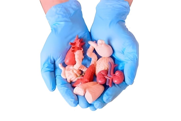 نقل وزراعة الأعضاء